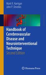 Handbook Of Cerebrovascular Disease And Neurointerventional Technique 2nd Edition Mark R Harrigan