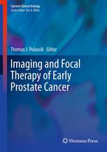 Imaging And Focal Therapy Of Early Prostate Cancer 1st Edition Joseph A Graversen Md
