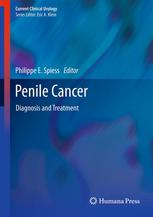 Penile Cancer Diagnosis And Treatment 1st Edition Philippe E Spiess Eds