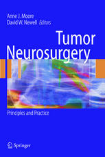 Tumor Neurosurgery Principles And Practice 1st Edition Allen E Waziri Md