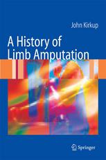 A History Of Limb Amputation 1st Edition John Kirkup Md Ma Frcs Auth