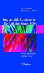 Implantable Cardioverter Defibrillator Stored Ecgs Clinical Management And Case Reports 1st Edition Luc J Jordaens Md