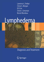 Lymphedema Diagnosis And Treatment 1st Edition Lawrence L Tretbar Md