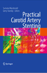 Practical Carotid Artery Stenting 1st Edition Jrg Ederle Martin M Brown Auth