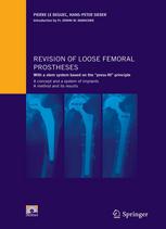Revision Of Loose Femoral Prostheses With A Stem System Based On The Pressfit Principle A Concept And A System Of Implants A Method And Its Results 1st Edition Dr Pierre Le Bguec