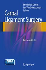 Carpal Ligament Surgery Before Arthritis 1st Edition V Feipel Auth