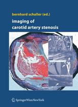 Imaging Of Carotid Artery Stenosis 1st Edition B J Schaller Auth