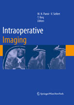 Intraoperative Imaging 1st Edition Peter Black Ferenc A Jolesz