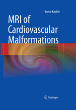 Mri Of Cardiovascular Malformations 1st Edition Bruno Kastler Auth