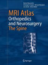 Mri Atlas Orthopedics And Neurosurgery The Spine 1st Edition Dr Martin Weyreuther