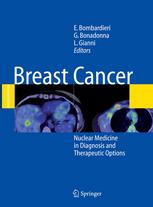 Breast Cancer Nuclear Medicine In Diagnosis And Therapeutic Options 1st Edition Emilio Bombardieri Md