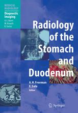 Radiology Of The Stomach And Duodenum 1st Edition Alan H Freeman Mb