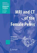 Mri And Ct Of The Female Pelvis 1st Edition Helga Fritsch Md Auth