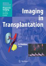 Imaging In Transplantation 1st Edition Christiane Kulinnacosentini Md