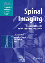 Spinal Imaging Diagnostic Imaging Of The Spine And Spinal Cord Andrea Rossi Md