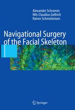 Navigational Surgery Of The Facial Skeleton 1st Edition Alexander Schramm Md Dds