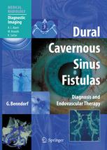 Dural Cavernous Sinus Fistulas Diagnostic And Endovascular Therapy 1st Edition Goetz Benndorf Md