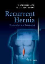 Recurrent Hernia Prevention And Treatment S Haapaniemi P Nordin