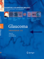 Glaucoma 1st Edition Nicholas E H Nick Wood Li Guo M Francesca Cordeiro Auth