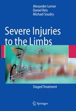 Severe Injuries To The Limbs Staged Treatment 1st Edition Alexander Lerner Md
