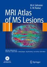 Mri Atlas Of Ms Lesions 1st Edition Mohammad Ali Sahraian Ernstwilhelm Radue Auth