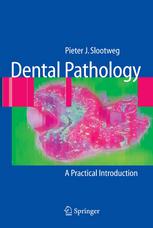 Dental Pathology A Practical Introduction Pieter J Slootweg Md