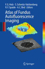 Atlas Of Fundus Autofluorscence Imaging 1st Edition Frank Holz
