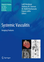 Systemic Vasculitis Imaging Features 1st Edition Anthony W Stanson Auth