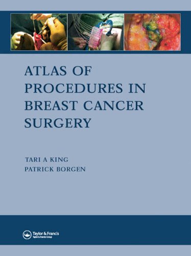 Atlas Of Procedures In Breast Cancer Surgery Tari A King Patrick I Borgen