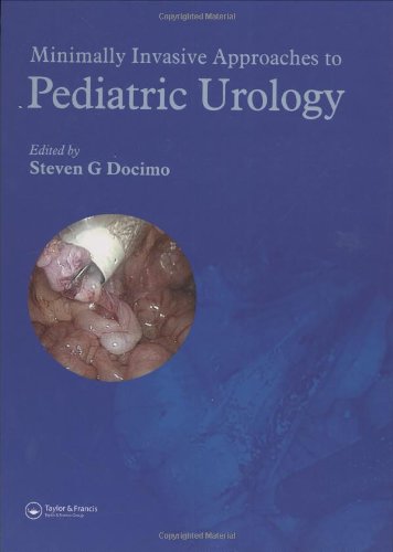 Minimally Invasive Approaches To Pediatric Urology 1st Edition Steven G Docimo
