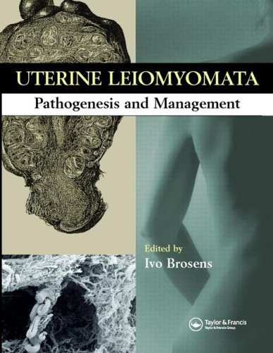 Uterine Leiomyomas Pathogenesis And Management 1st Edition Ivo Brosens