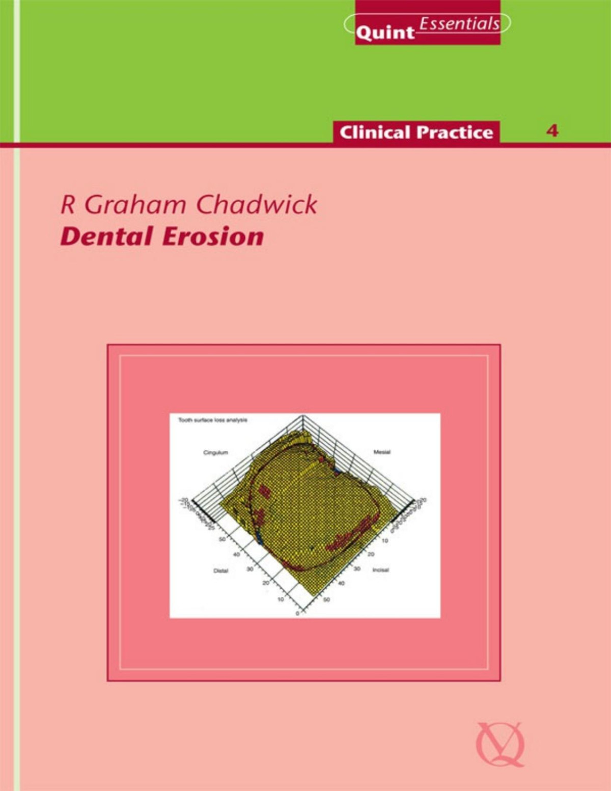 Dental Erosion R Graham Chadwick