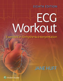 Ecg Workout Exercises In Arrhythmia Interpretation 8th Edition Jane Huff