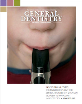 Peer Reviewed Journal Of The Academy Of General Dentistry Marchapril Dentistry