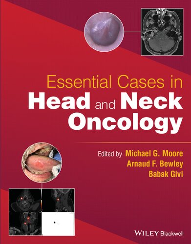 Essential Cases In Head And Neck Oncology 1st Edition Babak Givi