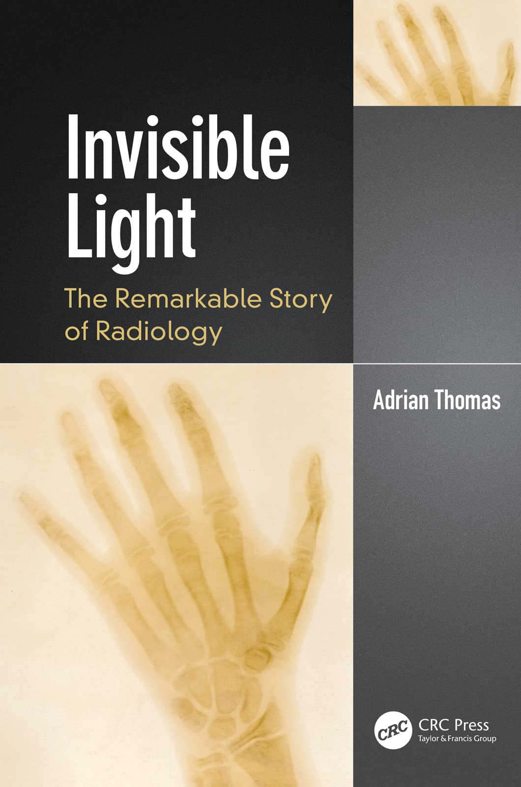 Invisible Light The Remarkable Story Of Radiology 1st Edition Adrian Thomas