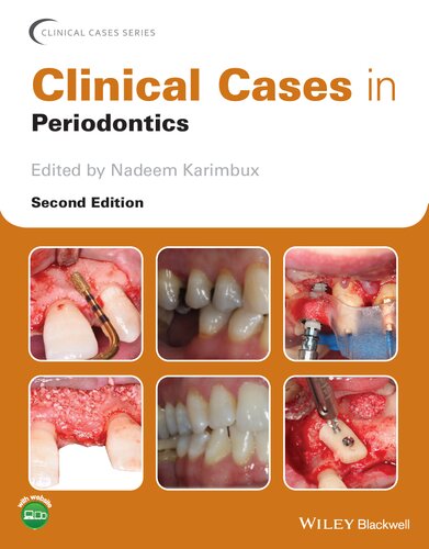 Clinical Cases In Periodontics 2nd Edition 2nd Nadeem Karimbux