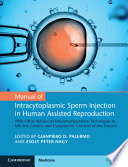 Manual Of Intracytoplasmic Sperm Injection In Human Assisted Reproduction Gianpiero D Palermo