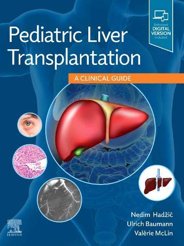 Pediatric Liver Transplantation A Clinical Guide 1st Edition Nedim Hadzic