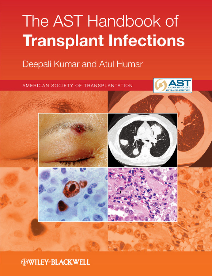 The Ast Handbook Of Transplant Infections Kumar Deepali Humar