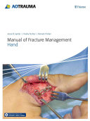 Manual Of Fracture Management Hand Jupiter Jesse B Edt Fricker