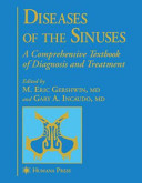 Diseases Of The Sinuses M Eric Gershwin Gary Incaudo