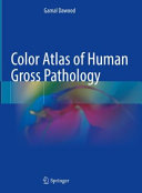 Color Atlas Of Human Gross Pathology Gamal Dawood