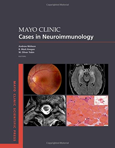 Mayo Clinic Cases In Neuroimmunology Andrew Mckeon B Mark Keegan