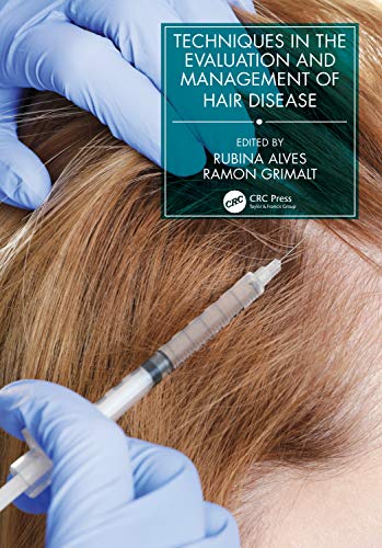 Techniques In The Evaluation And Management Of Hair Diseases Rubina Alves Ramon Grimalt