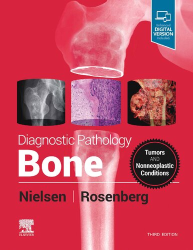 Diagnostic Pathology Bone 3rd Edition 3rd Edition Gunnlaugur Petur Nielsen