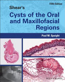Shears Cysts Of The Oral And Maxillofacial Regions 5th Edition Paul Speight