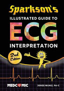 Sparksons Illustrated Guide To Ecg Interpretation 2nd Edition Muniz