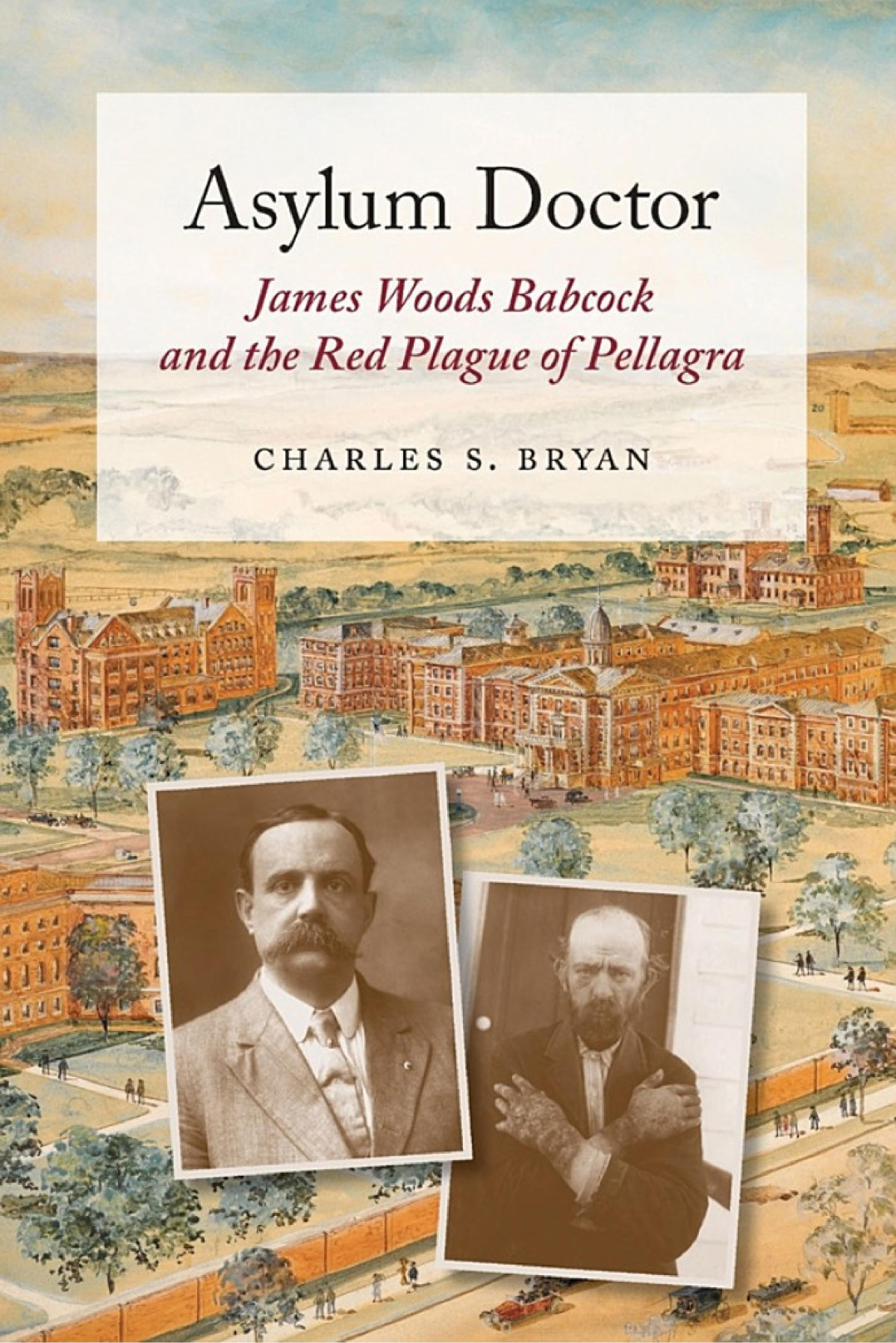 Asylum Doctor James Woods Babcock And The Red Plague Of Pellagra Charles S Bryan