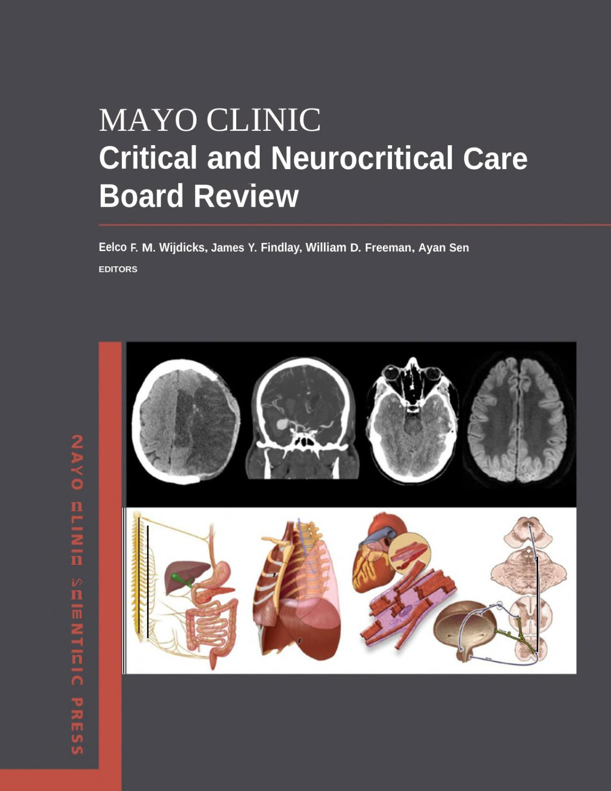 Mayo Clinic Critical And Neurocritical Care Board Review Eelco Fm Wijdicks Md